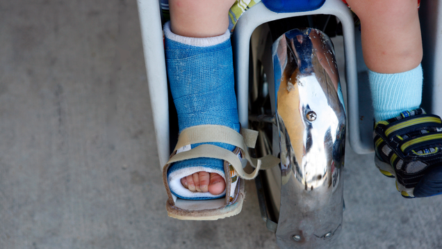 Illustration for article titled 10 Adorable Pictures Of Little Kids In Casts That Will Make You Wish More Children Broke Bones